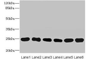 Western blot All lanes: FKBP14 antibody at 1 μg/mL Lane 1: Mouse stomach tissue Lane 2: Mouse gonadal tissue Lane 3: U937 whole cell lysate Lane 4: PC-3 whole cell lysate Lane 5: 293T whole cell lysate Lane 6: THP-1 whole cell lysate Secondary Goat polyclonal to rabbit IgG at 1/10000 dilution Predicted band size: 25 kDa Observed band size: 25 kDa (FKBP14 antibody  (AA 20-211))