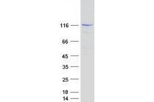 Western Blotting (WB) image for Janus Kinase 1 (JAK1) protein (Myc-DYKDDDDK Tag) (ABIN2734726)