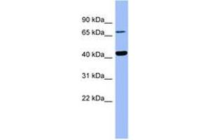 Image no. 1 for anti-4-Hydroxyphenylpyruvate Dioxygenase (HPD) (AA 179-228) antibody (ABIN6741738) (HPD antibody  (AA 179-228))