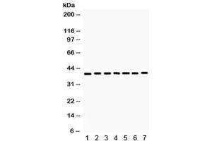 Western blot testing of  rat 1) skeletal muscle, 2) kidney, 3) heart, 4) NRK, and human 5) 293, 6) HeLa and 7) MCF7 lysate with HDAC11 antibody. (HDAC11 antibody)