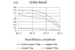 Black line: Control Antigen (100 ng),Purple line: Antigen (10 ng), Blue line: Antigen (50 ng), Red line:Antigen (100 ng) (SAA1 antibody  (AA 19-212))