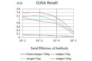 Black line: Control Antigen (100 ng),Purple line: Antigen (10 ng), Blue line: Antigen (50 ng), Red line:Antigen (100 ng) (SAA1 antibody  (AA 19-212))