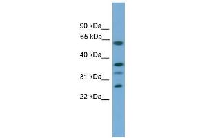 WB Suggested Anti-APOL2 Antibody Titration:  0. (Apolipoprotein L 2 antibody  (Middle Region))