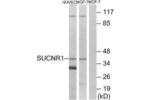 Western Blotting (WB) image for anti-Succinate Receptor 1 (SUCNR1) (Internal Region) antibody (ABIN1853343) (SUCNR1 antibody  (Internal Region))