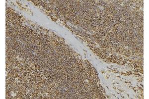 ABIN6279673 at 1/100 staining Human lymph node tissue by IHC-P. (PABPC3 antibody)