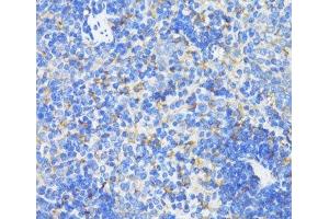 Immunohistochemistry of paraffin-embedded Mouse spleen using SDHB Polyclonal Antibody at dilution of 1:100 (40x lens). (SDHB antibody)