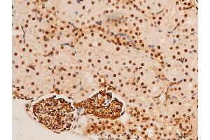 Immunohistochemistry (IHC) image for anti-Jun Proto-Oncogene (JUN) (pThr91) antibody (ABIN6256604)