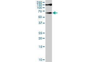 TYR MaxPab rabbit polyclonal antibody. (TYR antibody  (AA 1-377))