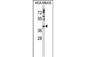 Western blot analysis in MDA-MB435 cell line lysates (35ug/lane). (DNAJC28 antibody  (C-Term))