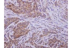 Image no. 1 for anti-Aldo-Keto Reductase Family 1, Member D1 (AKR1D1) (AA 1-326) antibody (ABIN1496548) (AKR1D1 antibody  (AA 1-326))