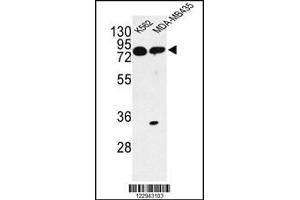 Western blot analysis of PRKAA1 Antibody in K562, MDA-MB435 cell line lysates (35ug/lane) (PRKAA1 antibody)