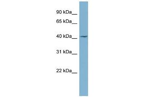 WB Suggested Anti-LASS1 Antibody Titration:  0. (LASS1 antibody  (Middle Region))