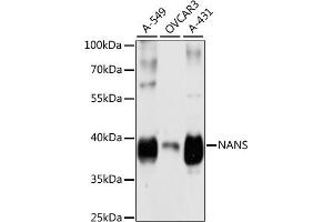 Western blot analysis of extracts of various cell lines, using NANS antibody  at 1:3000 dilution. (NANS antibody  (AA 260-359))