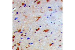 Immunohistochemical analysis of IKK beta (pT19) staining in human brain formalin fixed paraffin embedded tissue section.