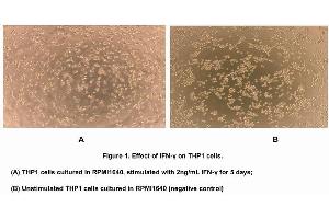 Image no. 2 for Interferon gamma (IFNG) (AA 24-166) (Active) protein (His tag) (ABIN6239726)