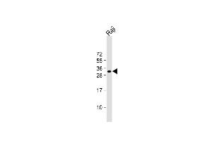 Anti-HLA-DQA1 Antibody (N-term) at 1:1000 dilution + Raji whole cell lysate Lysates/proteins at 20 μg per lane. (HLA-DQA1 antibody  (N-Term))