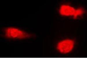 Immunofluorescent analysis of JNK1/2/3 (pT183) staining in NIH3T3 cells.