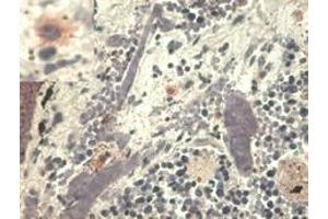 Immunohistochemistry (Paraffin-embedded Sections) (IHC (p)) image for anti-HLA Class I Histocompatibility Antigen, alpha Chain G (HLAG) antibody (ABIN94366)