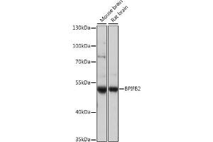 Western blot analysis of extracts of various cell lines, using BPIFB2 antibody (ABIN7265907) at 1:1000 dilution. (BPIL1 antibody  (AA 40-340))