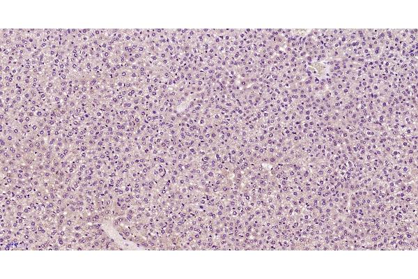 Complement Component C9b (C9b) (AA 251-350) antibody