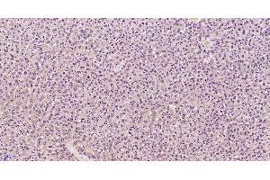 Paraformaldehyde-fixed, paraffin embedded Mouse liver, Antigen retrieval by boiling in sodium citrate buffer (pH6. (Complement Component C9b (C9b) (AA 251-350) antibody)