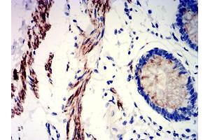 Immunohistochemical analysis of paraffin-embedded rectum tissues using PRKAG3 mouse mAb with DAB staining. (PRKAG3 antibody  (AA 9-151))