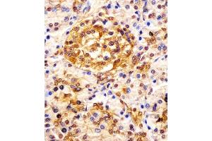 (ABIN652121 and ABIN2840556) staining ESRP1 in human pancreas tissue sections by Immunohistochemistry (IHC-P - paraformaldehyde-fixed, paraffin-embedded sections). (ESRP1 antibody  (AA 182-211))