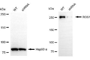 Western blotting analysis using ROS1 antibody (ABIN7797813). (ROS1 antibody)