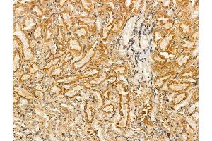 ABIN7094604 and ABIN7098654 at 1/100 staining Rat kidney tissue by IHC-P. (PLVAP antibody  (C-Term))