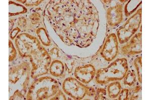 IHC image of ABIN7175445 diluted at 1:200 and staining in paraffin-embedded human kidney tissue performed on a Leica BondTM system. (PTPLAD1 antibody  (AA 1-145))