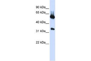 WB Suggested Anti-ALAS2 Antibody Titration:  0. (ALAS2 antibody  (N-Term))