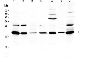 Western blot analysis of Ccl19/MIP-3 beta using anti-Ccl19/MIP-3 beta antibody .