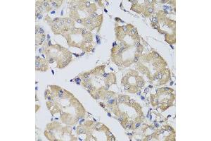 Immunohistochemistry of paraffin-embedded human gastric using BPGM antibody at dilution of 1:100 (x40 lens).