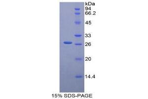 SDS-PAGE (SDS) image for Glucuronidase, beta (GUSB) (AA 451-648) protein (His tag) (ABIN2124976)