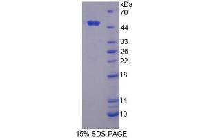 Image no. 1 for Ring Finger Protein 39 (RNF39) (AA 1-420) protein (His tag) (ABIN6237078)
