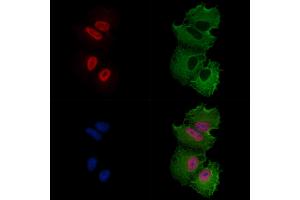 ABIN6256915 and ABIN6274184 staining  cells by IF/ICC.