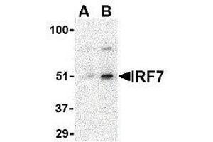 Western Blotting (WB) image for anti-Interferon Regulatory Factor 7 (IRF7) (Center) antibody (ABIN2475145) (IRF7 antibody  (Center))