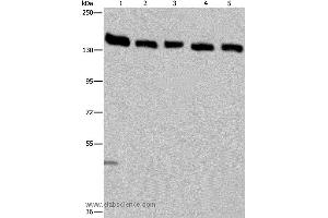 Western blot analysis of Hela cell and human testis tissue, A549, Jurkat and K562 cell, using IPO4 Polyclonal Antibody at dilution of 1:550 (Importin 4 antibody)