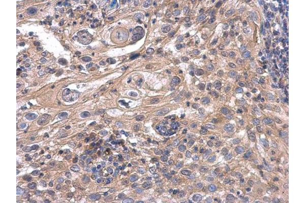 ACOX3 antibody  (C-Term)