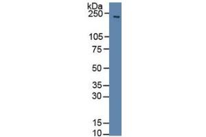 Rabbit Capture antibody from the kit in WB with Positive Control: Sample Rat brain tissue. (SLIT1 ELISA Kit)