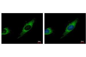 Image no. 3 for anti-Transforming Growth Factor beta Regulator 4 (TBRG4) (AA 1-328) antibody (ABIN1501337)