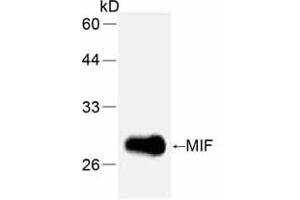 Western Blotting (WB) image for anti-Macrophage Migration Inhibitory Factor (Glycosylation-Inhibiting Factor) (MIF) (full length) antibody (ABIN1854219) (MIF antibody  (full length))