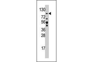 Western blot analysis of USP33 polyclonal antibody  in T-47D cell line lysate (35 ug/lane). (USP33 antibody  (C-Term))