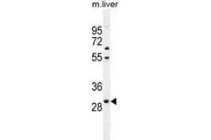 Western blot analysis in mouse liver tissue lysates (35ug/lane) using PHOX2B  Antibody . (PHOX2B antibody  (Middle Region))