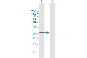 Western Blot analysis of FOLR1 expression in transfected 293T cell line by FOLR1 MaxPab polyclonal antibody. (FOLR1 antibody  (AA 1-257))