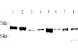 Western blot analysis of ZCCHC7 (ABIN7076279) at dilution of 1: 4000,Lane 1: HeLa cell lysate,Lane 2: K562 cell lysate,Lane 3: HL60 cell lysate,Lane 4: Mouse brain tissue lysate,Lane 5: Mouse kidney tissue lysate,Lane 6: Rat brain tissue lysate,Lane 7: Rat kidney tissue lysate,Lane 8: Rat uterus tissue lysate (ZCCHC7 antibody)