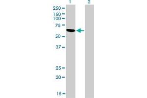 Western Blot analysis of RBM5 expression in transfected 293T cell line by RBM5 monoclonal antibody (M01), clone 2B6.