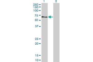 Western Blot analysis of STK3 expression in transfected 293T cell line by STK3 monoclonal antibody (M13A), clone 4F7. (STK3 antibody  (AA 311-431))