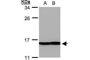 WB Image Sample(30 ug whole cell lysate) A: A431, B: H1299 12% SDS PAGE antibody diluted at 1:500
