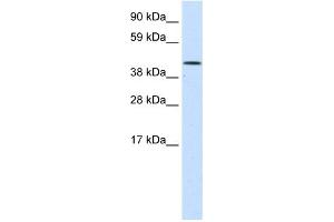 WB Suggested Anti-SMARCA1 Antibody Titration:  1. (SMARCA1 antibody  (N-Term))